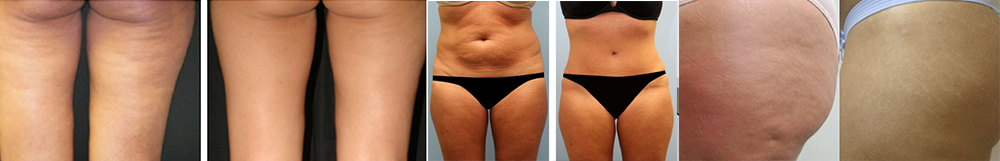 11.70 € GALVANC BODY SPA 11.70 € GALVANC BODY SPA