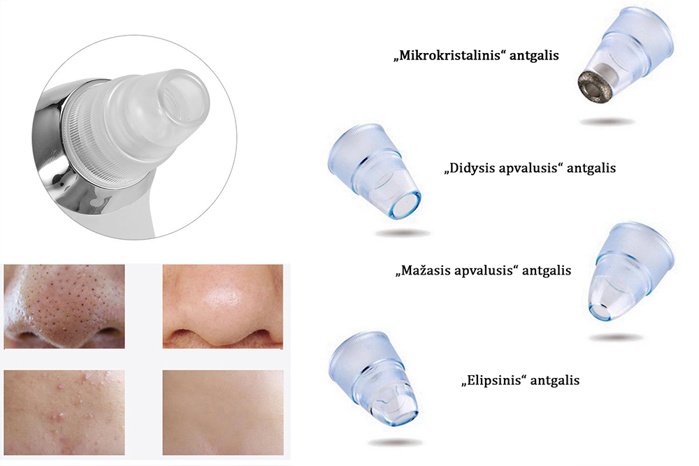 27.00 € Kraunamas veido odos ir porų valymo prietaisais