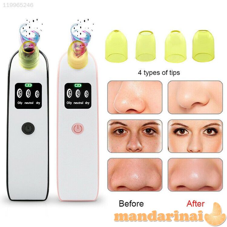 Elektrinis vakuuminis veido porų valymo prietaisas