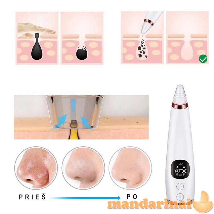 Veido odos ir porų valymo prietaisas 5