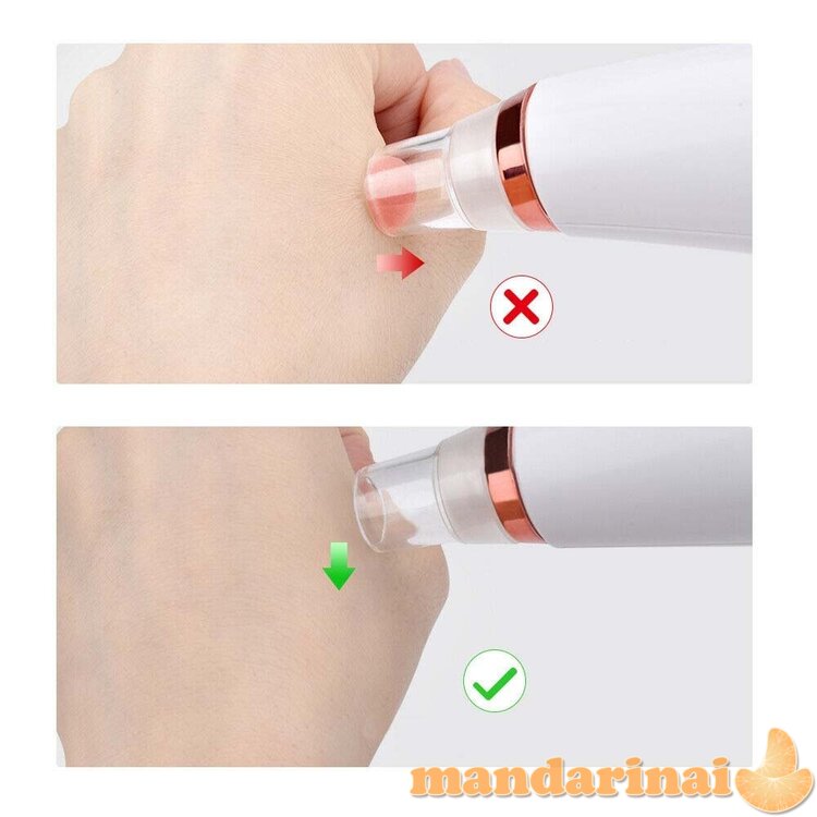 Veido odos ir porų valymo prietaisas 8