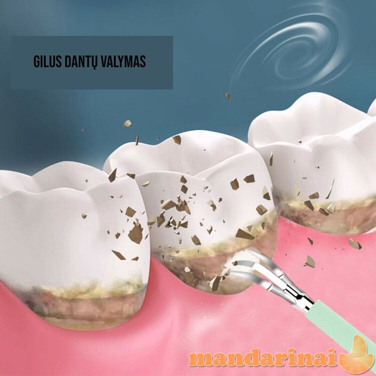 Vibracinis rinkinys dantų valymui ir higienai